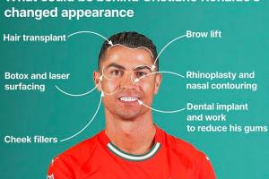 40岁仍皮肤光滑，整形医生分析：C罗面部可能进行过多次整形手术